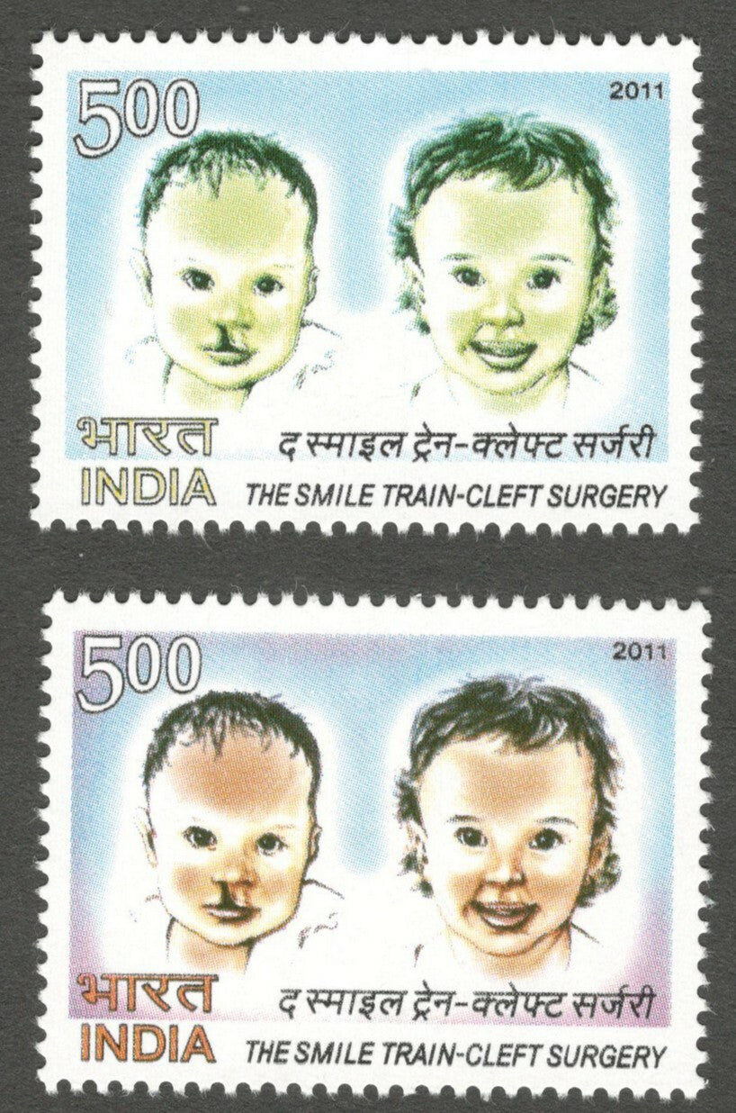 AOP India 2011 Train-Cleft Surgery RED OMITTED error MNH
