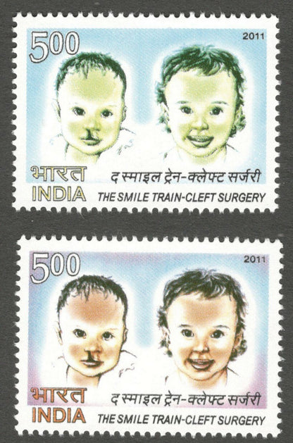 AOP India 2011 Train-Cleft Surgery RED OMITTED error MNH