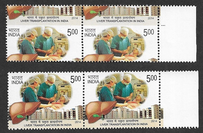 India 2014 Liver Transplant massive perforation shift pair MNH